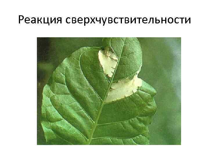 Реакция сверхчувствительности 