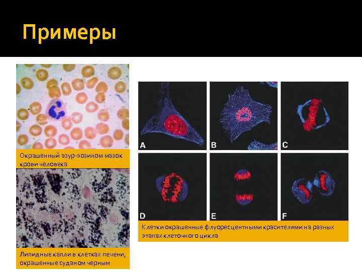 Этапа клетка. Красители в цитологии. Ядерные структуры клеток окрашиваются красителями. Окрашивание клетки пример. Ядро клетки окрашивается красителями.