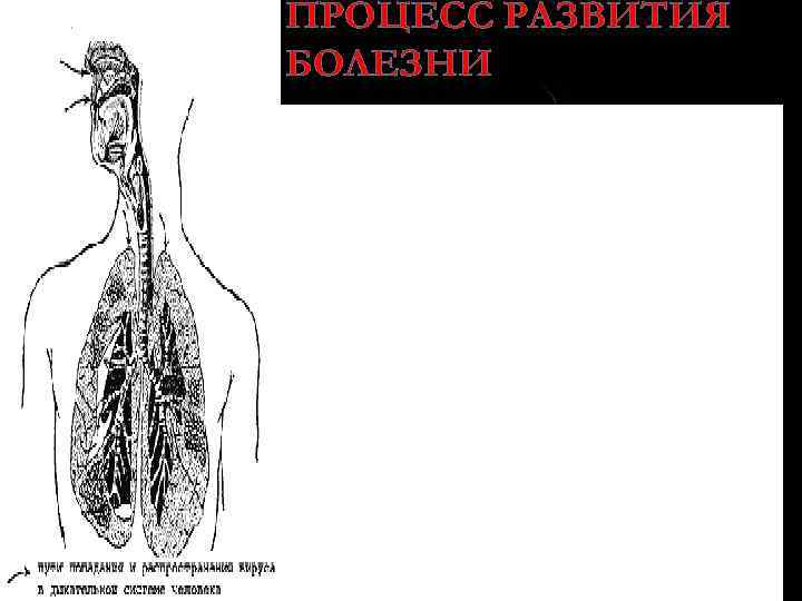 ПРОЦЕСС РАЗВИТИЯ БОЛЕЗНИ n Вирус, попав на слизистые оболочки верхних дыхательных путей, проникает в