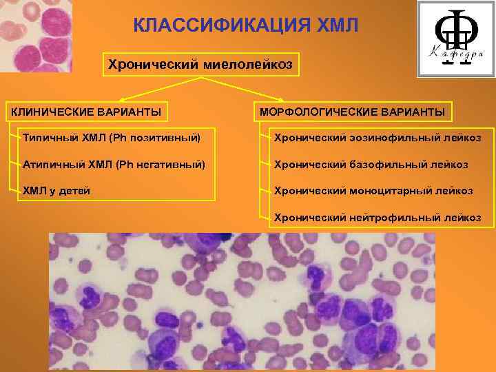 При хроническом миеломоноцитарном лейкозе в картине крови характерен тест ответ