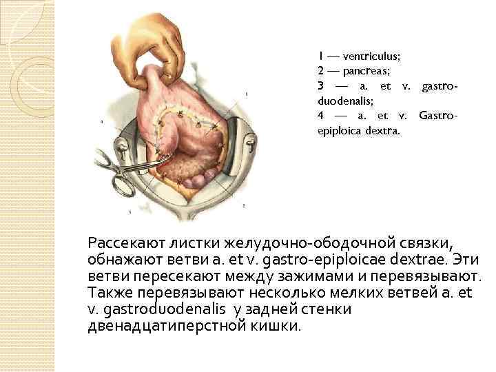 1 — ventriculus; 2 — pancreas; 3 — a. et v. gastroduodenalis; 4 —