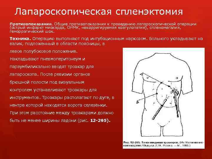 Лапароскопическая спленэктомия Противопоказания. Общие противопоказания к проведению лапароскопической операции (острый инфаркт миокарда, OHMК, некорригируемая