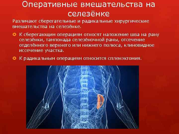 Оперативные вмешательства на селезёнке Различают сберегательные и радикальные хирургические вмешательства на селезёнке. К сберегающим