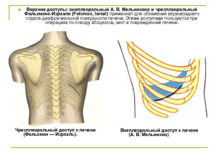 Схема распространения патологических процессов по брюшной полости