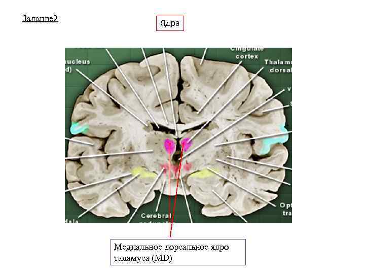 Задание 2 Ядра Медиальное дорсальное ядро таламуса (MD) 