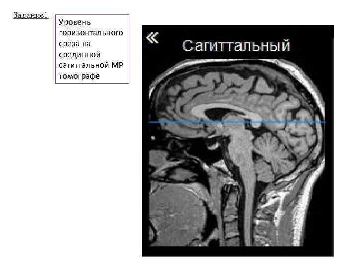 Задание 1 Уровень горизонтального среза на срединной сагиттальной МР томографе 