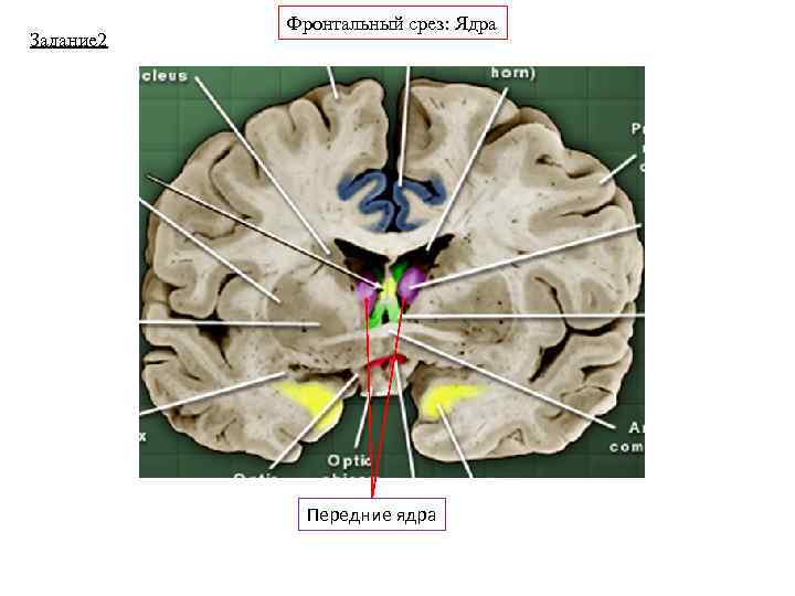 Задание 2 Фронтальный срез: Ядра Передние ядра 