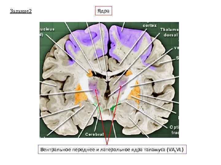 Задание 2 Ядра Вентральное переднее и латеральное ядра таламуса (VA, VL) 