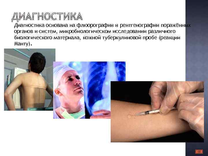 Диагностика основана на флюорографии и рентгенографии поражённых органов и систем, микробиологическом исследовании различного биологического