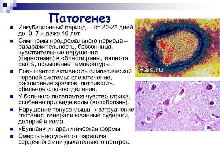 n n n n Патогенез Инкубационный период – от 20 -25 дней до 3,
