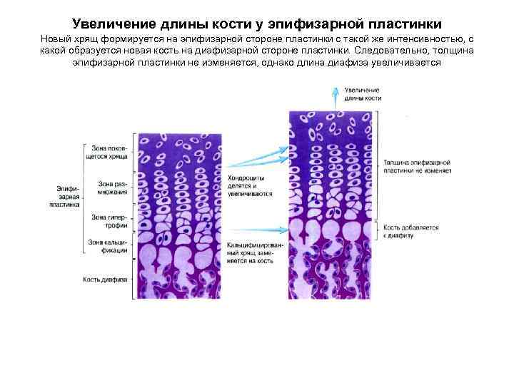 Пластина роста. Препарат эпифизарной пластинки гистология. Эпифизарная пластинка роста кости. Костная ткань гистология метаэпифизарная пластинка. . Непрямой остеогенез - эпифизарная пластинка роста.