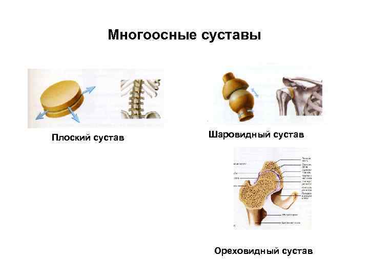 Многоосные суставы Плоский сустав Шаровидный сустав Ореховидный сустав 