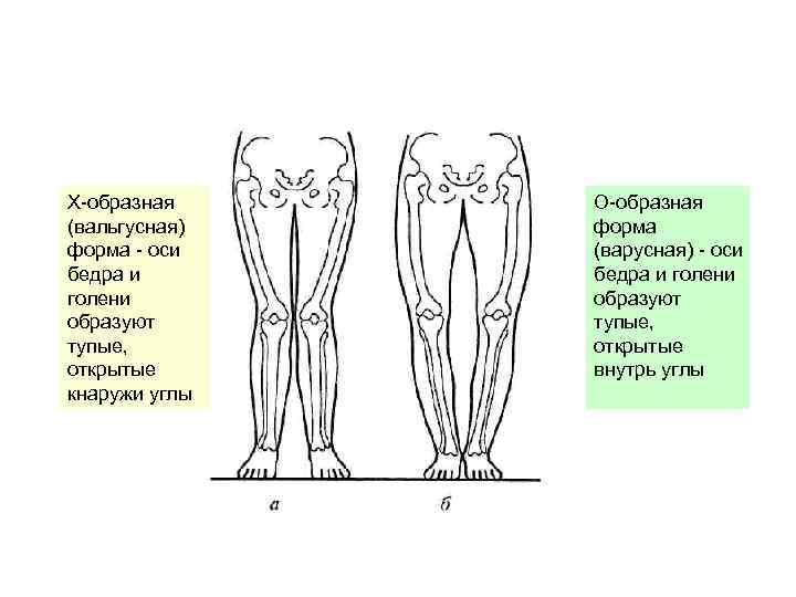 Форму оси. Ротация бедра. Внутренняя ротация бедра. Внутренняя и наружная ротация бедра. Наружная ротация бедра.