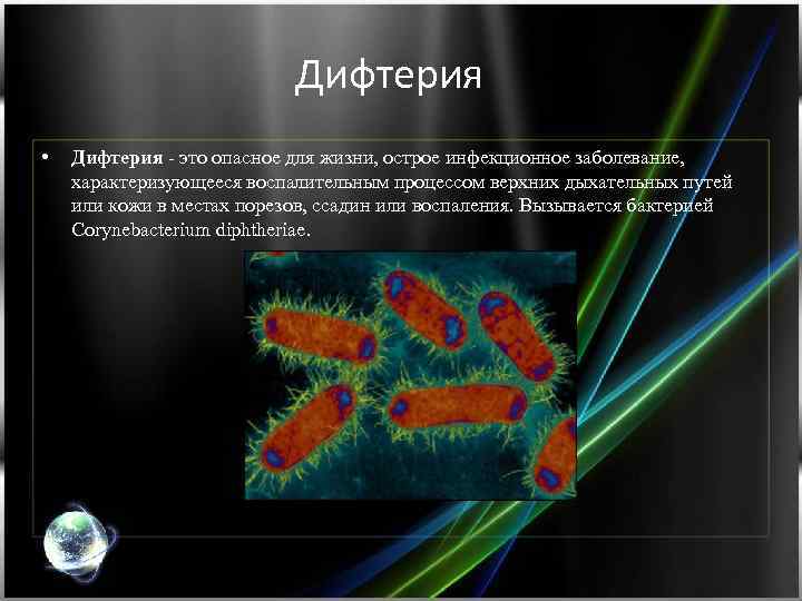 Дифтерия • Дифтерия - это опасное для жизни, острое инфекционное заболевание, характеризующееся воспалительным процессом