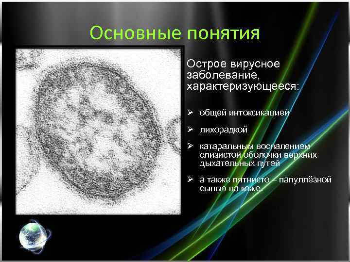 Основные понятия Острое вирусное заболевание, характеризующееся: Ø общей интоксикацией Ø лихорадкой Ø катаральным воспалением