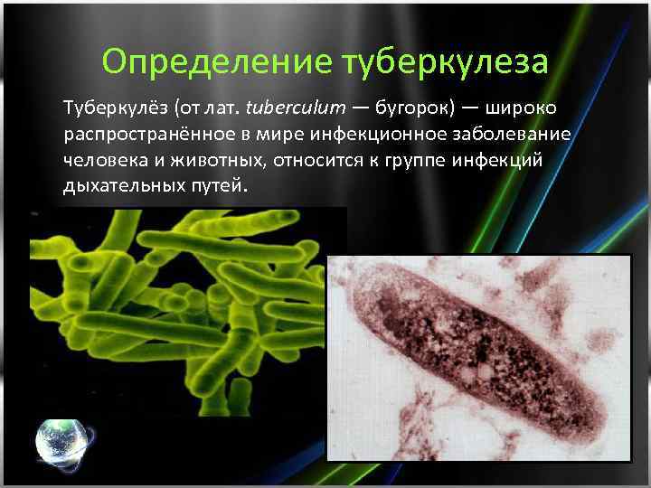 Определение туберкулеза Туберкулёз (от лат. tuberculum — бугорок) — широко распространённое в мире инфекционное