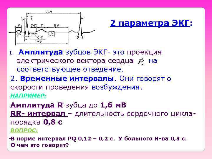 2 параметра ЭКГ: Амплитуда зубцов ЭКГ- это проекция электрического вектора сердца на соответствующее отведение.