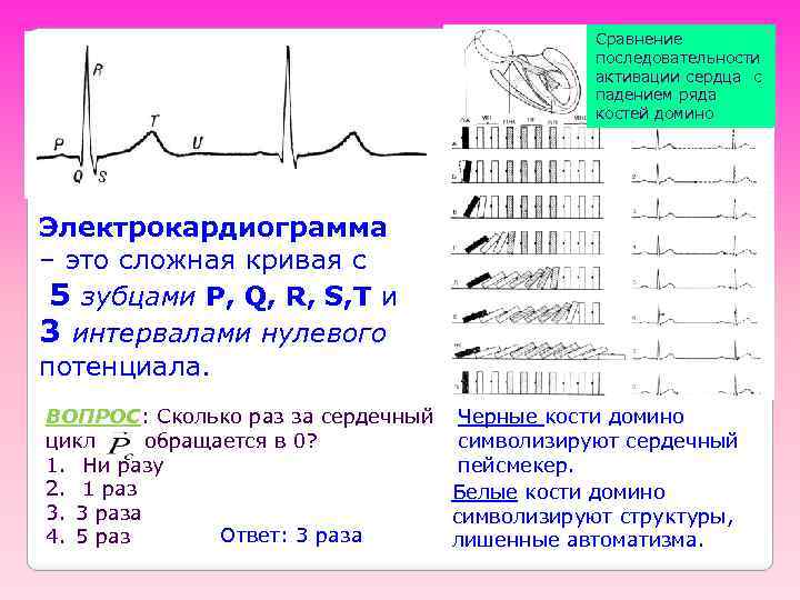 Сравнение последовательности активации сердца с падением ряда костей домино Электрокардиограмма – это сложная кривая