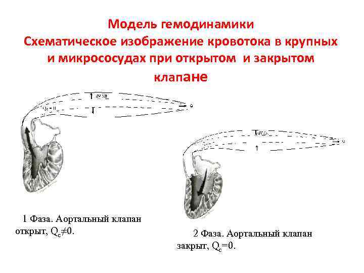 Модель гемодинамики Схематическое изображение кровотока в крупных и микрососудах при открытом и закрытом клапане
