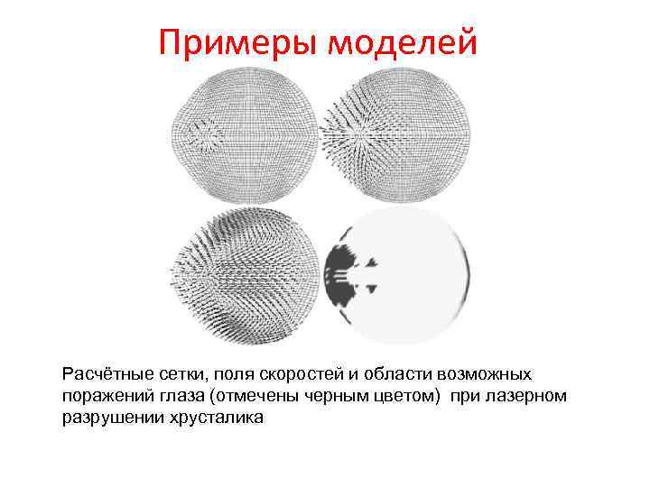 Примеры моделей Расчётные сетки, поля скоростей и области возможных поражений глаза (отмечены черным цветом)