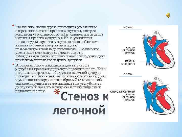 * Увеличение постнагрузки приводит к увеличению * напряжения в стенке правого желудочка, которое компенсируется