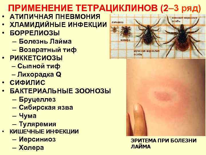 ПРИМЕНЕНИЕ ТЕТРАЦИКЛИНОВ (2– 3 ряд) • АТИПИЧНАЯ ПНЕВМОНИЯ • ХЛАМИДИЙНЫЕ ИНФЕКЦИИ • БОРРЕЛИОЗЫ –