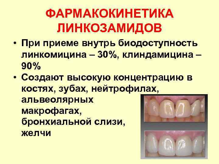 ФАРМАКОКИНЕТИКА ЛИНКОЗАМИДОВ • При приеме внутрь биодоступность линкомицина – 30%, клиндамицина – 90% •
