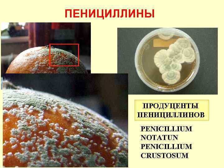 ПЕНИЦИЛЛИНЫ ПРОДУЦЕНТЫ ПЕНИЦИЛЛИНОВ PENICILLIUM NOTATUN PENICILLIUM CRUSTOSUM 