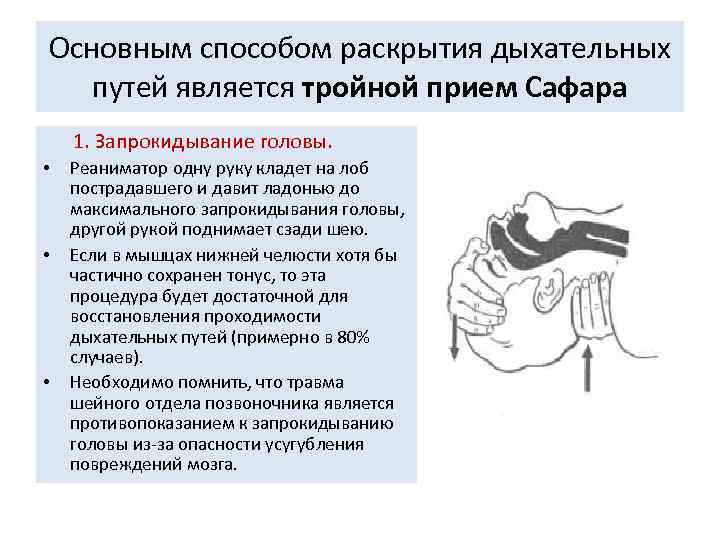 Основным способом раскрытия дыхательных путей является тройной прием Сафара 1. Запрокидывание головы. • •
