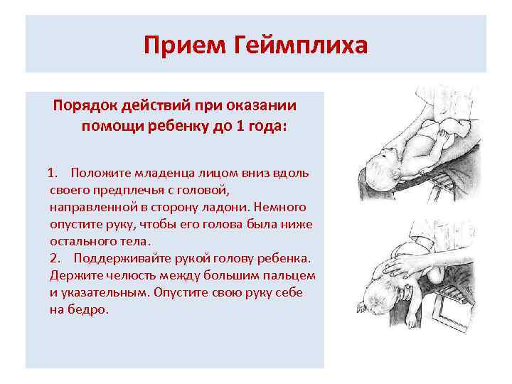 Прием Геймплиха Порядок действий при оказании помощи ребенку до 1 года: 1. Положите младенца