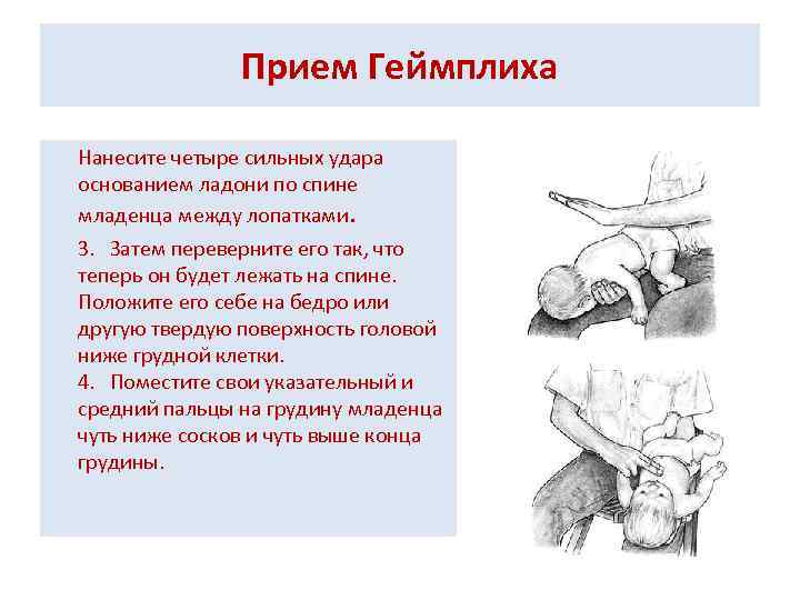 Прием Геймплиха Нанесите четыре сильных удара основанием ладони по спине младенца между лопатками. 3.