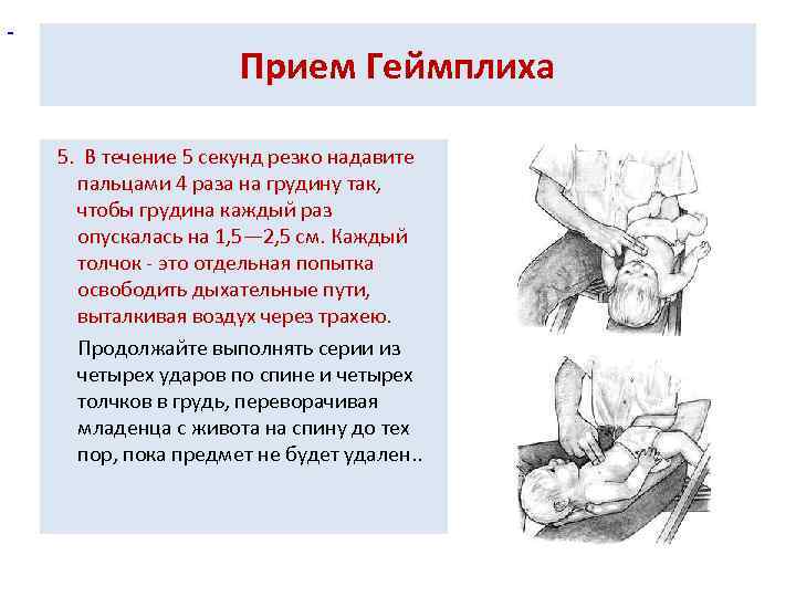Прием Геймплиха 5. В течение 5 секунд резко надавите пальцами 4 раза на грудину