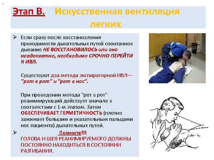 . Этап В. Искусственная вентиляция легких Ø Если сразу после восстановления проходимости дыхательных путей