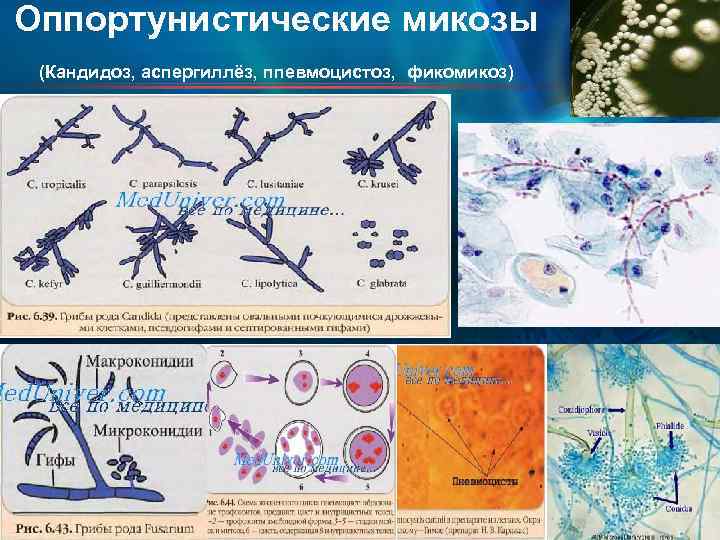 Оппортунистические микозы (Кандидоз, аспергиллёз, ппевмоцистоз, фикомикоз) 