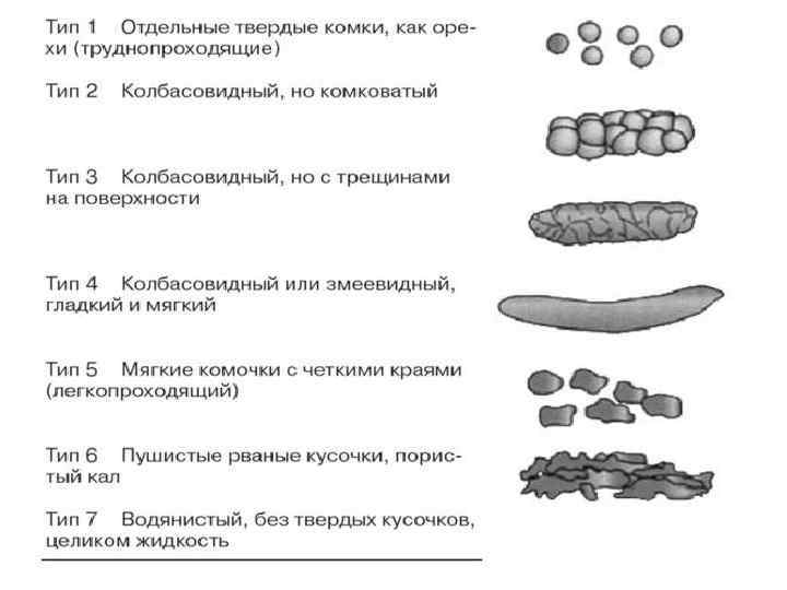 Синдром кишечной диспепсии дифференциальная диагностика