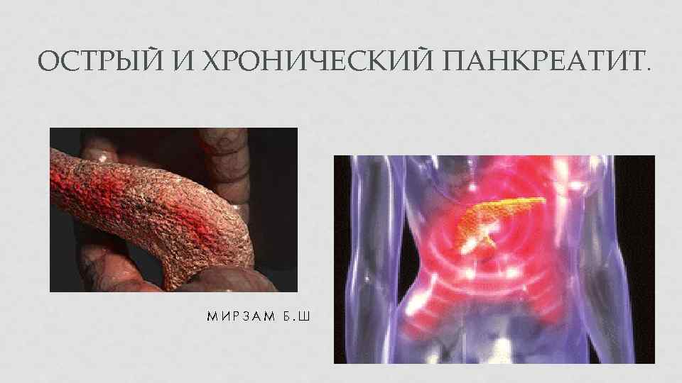 ОСТРЫЙ И ХРОНИЧЕСКИЙ ПАНКРЕАТИТ. МИРЗАМ Б. Ш 