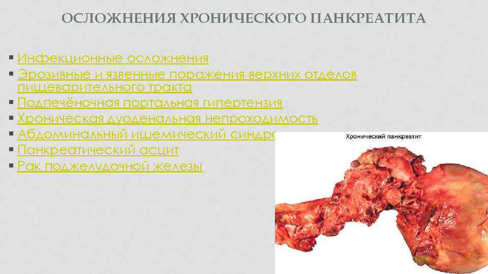 ОСЛОЖНЕНИЯ ХРОНИЧЕСКОГО ПАНКРЕАТИТА § Инфекционные осложнения § Эрозивные и язвенные поражения верхних отделов пищеварительного