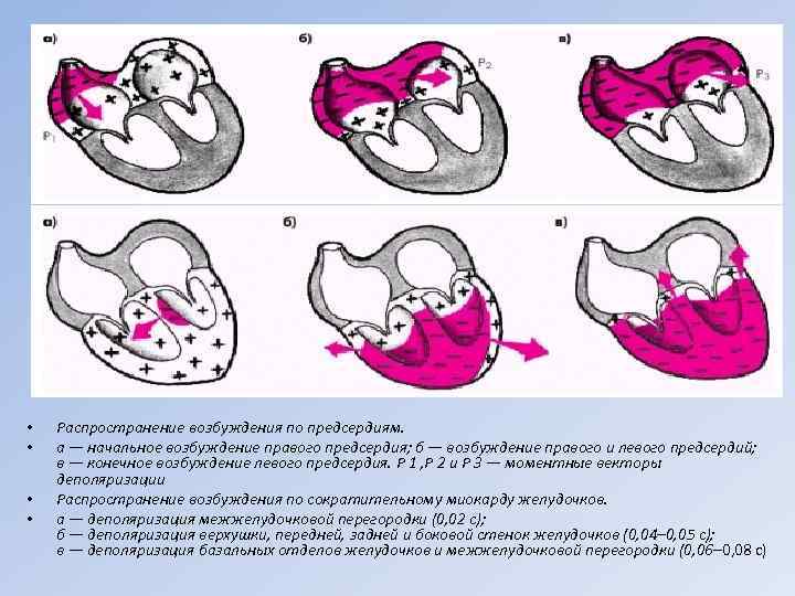  • • Распространение возбуждения по предсердиям. а — начальное возбуждение правого предсердия; б