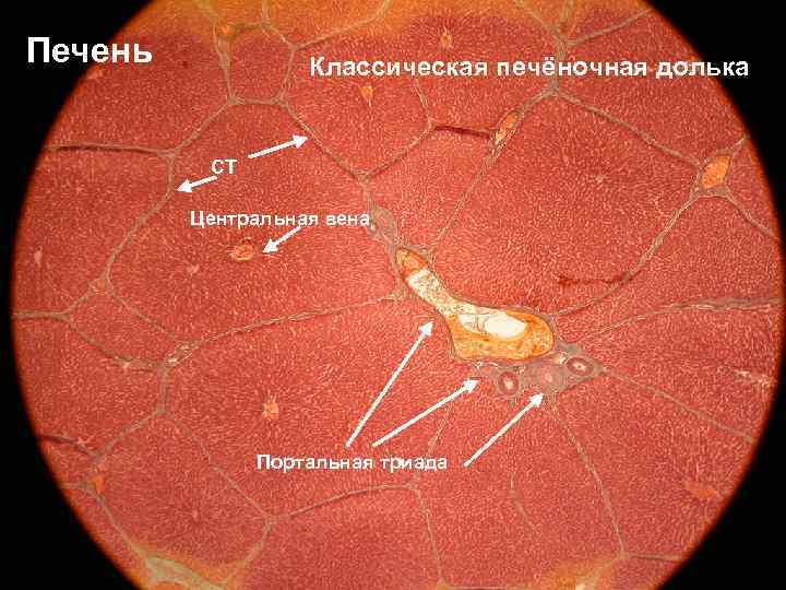 Печень Классическая печёночная долька CT Центральная вена Портальная триада 