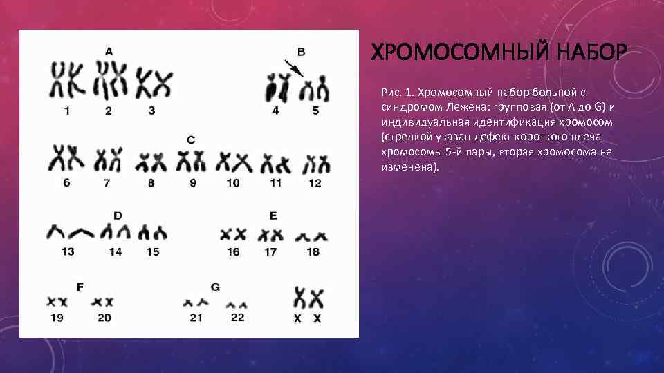 Синдром кошачьего крика презентация по генетике