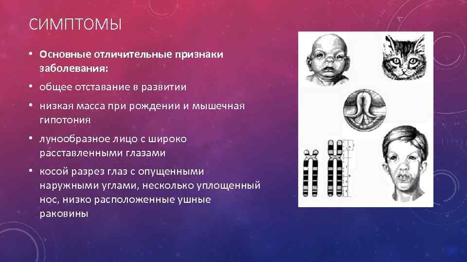 СИМПТОМЫ • Основные отличительные признаки заболевания: • общее отставание в развитии • низкая масса