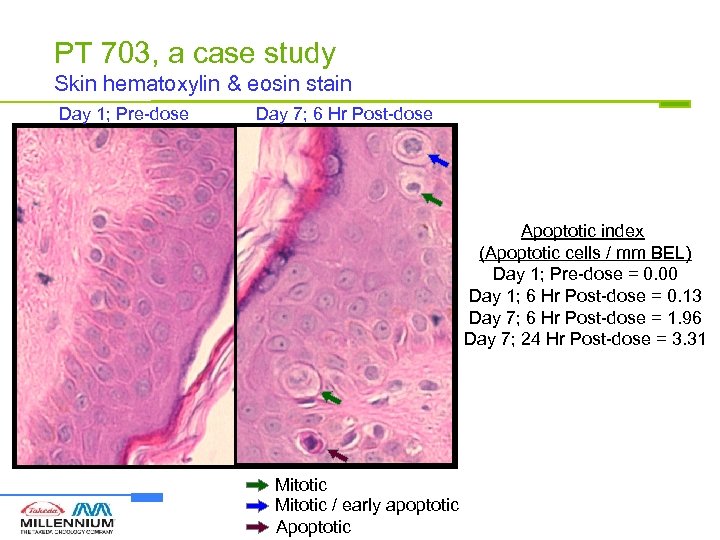 PT 703, a case study Skin hematoxylin & eosin stain Day 1; Pre-dose Day