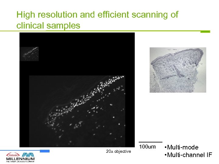 High resolution and efficient scanning of clinical samples 20 x objective 100 um •