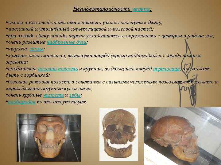 Неандерталоидность черепа: • голова в мозговой части относительно узка и вытянута в длину; •