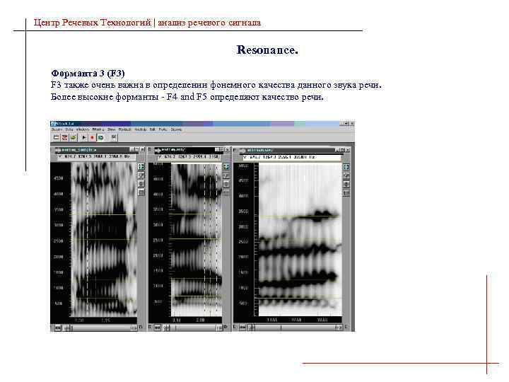Центр Речевых Технологий | анализ речевого сигнала Resonance. Форманта 3 (F 3) F 3