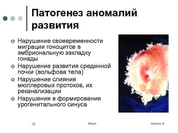 Патогенез аномалий развития ¢ ¢ Нарушение своевременности миграции гоноцитов в эмбриональную закладку гонады Нарушение