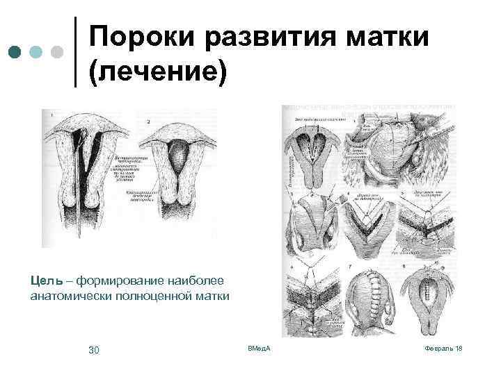 Картина инволютивных изменений матки и придатков