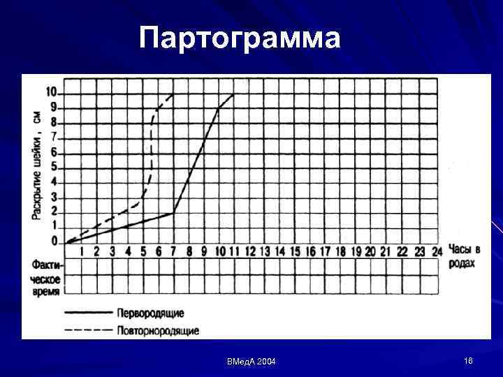 Партограмма ВМед. А 2004 16 