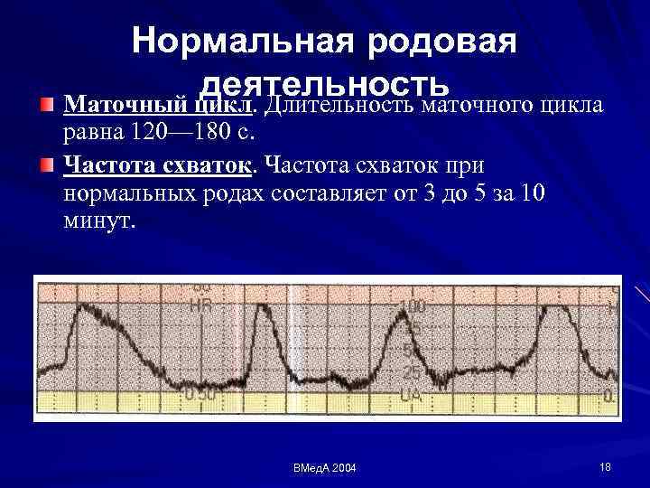 Родовая деятельность. Нормальная родовая деятельность. Нормсльная родовая дечт. Критерии нормальной родовой деятельности. КТГ при дискоординации родовой деятельности.