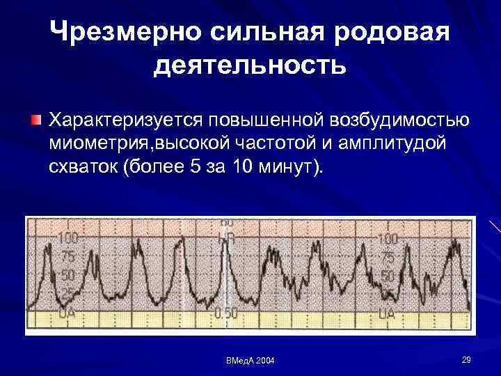 Родовая деятельность